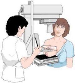El cáncer de mama se puede atajar con una mamografía