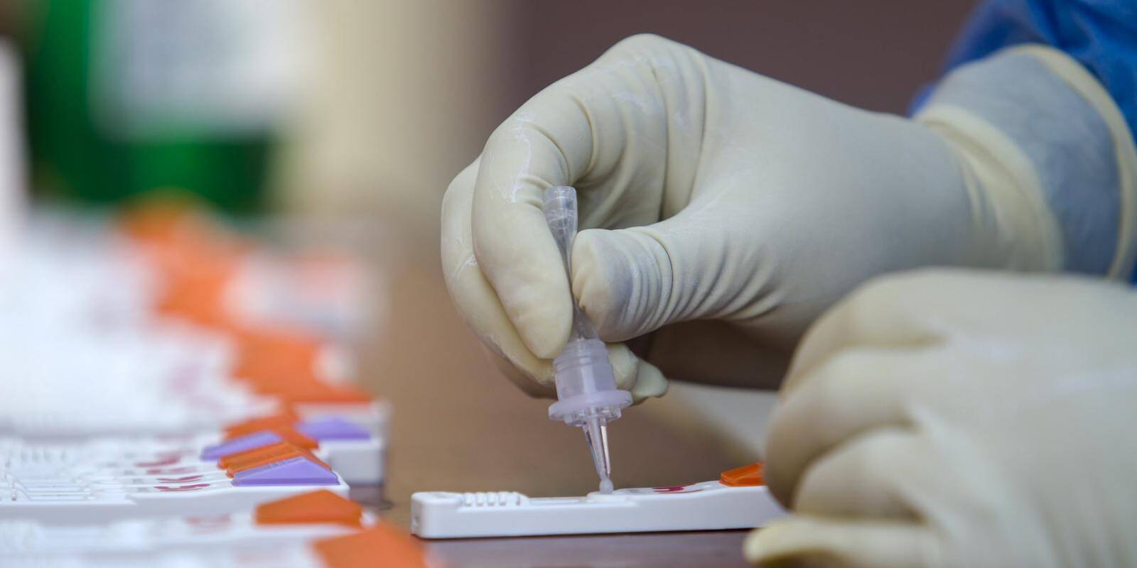 La incidencia de coronavirus sube en Pozuelo hasta los 204,81 casos
